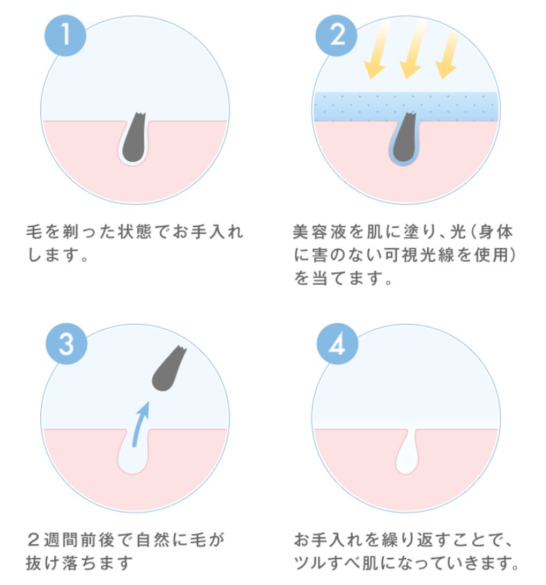 ミュゼの脱毛方法