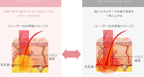 あおばクリニックの脱毛のレーザー